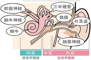 難聴