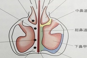 鼻中隔